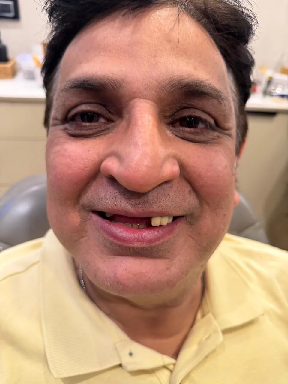 All-on-6 dental implant treatment room at Poly Dental Mohali